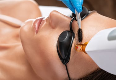 Détatouage progressif une approche douce sans agresser votre peau