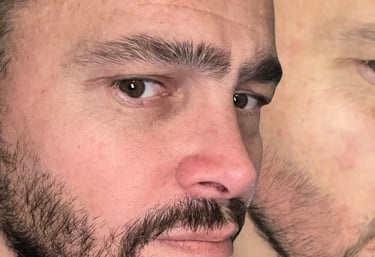 reconstruction du poil avec le protocole regen x