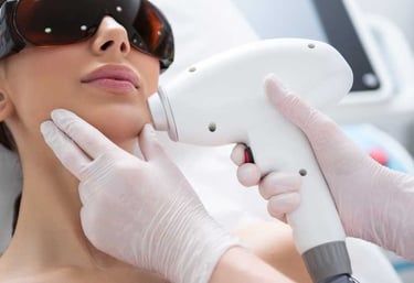 Nova - Permanent Ontharen