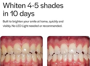 Teeth bleaching greenville SC