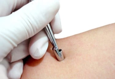 Tratamento_Dermatologico_Centro_Medico_Vida
