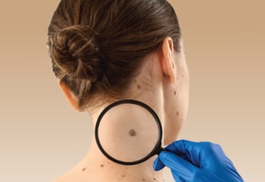 Skin Cancer Screening