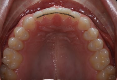 pictures of teeth