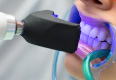 Blnaqueamiento dental en en Santo Domingo