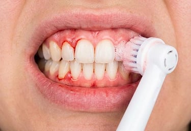 Les Inconvénients des Brosses à Dents Rotatives hygiene-precision.com