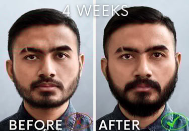 Before and after beard growth