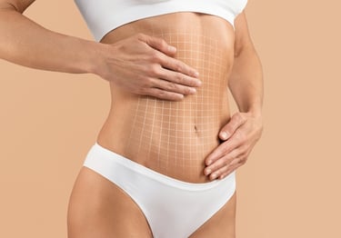 Abdominoplasty, breast reduction, mastopexy and liposuction to give you your dream body.