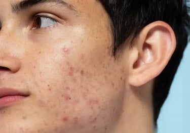 a man with a piercing on his nose and nose piercings