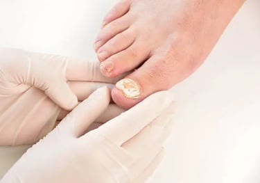 a person with a gold ring on their toenails