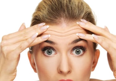 Botox para eliminar arrugas en frente, entrecejo y patas de gallo.