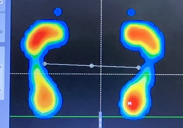 estudio biomecánica Podocenter