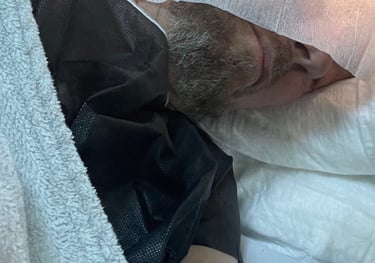 a hair transplant taking place in turkey