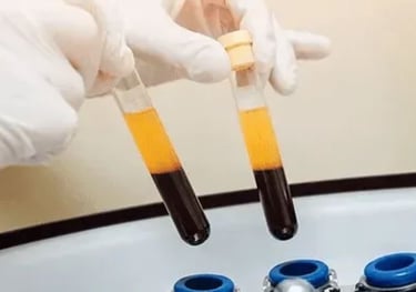 Tubos con plasma rico en plaquetas (PRP) utilizados en tratamientos de regeneración cutánea en AR Cl