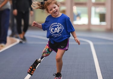 Helping children prosthetic limbs