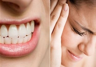 Tratamiento médico para bruxismo y perfilado facial en AR Clinic