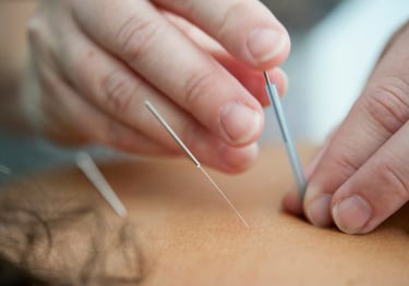 Dry needling therapy for muscle pain and trigger point release in Ballarat