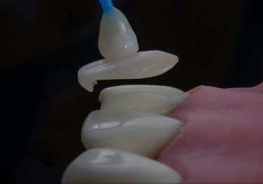 Faceta dental