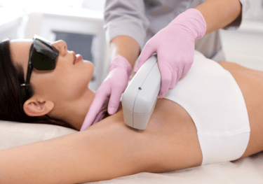 depilacion definitiva