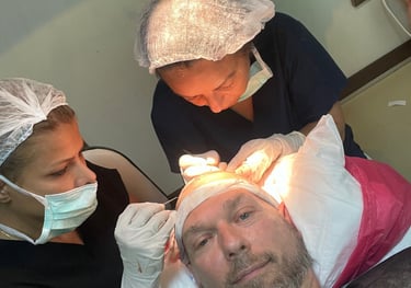 replacing the hair follicles in a hair transplant in Izmir in Turkey