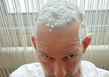 hair transplant dressings being removed