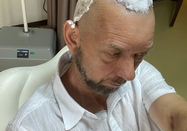 hair transplant dressings being removed