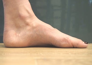 image of a high arch