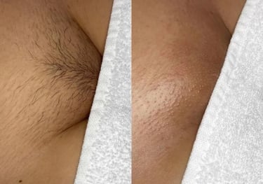 Brazilian Wax - New Gen Studio - Worthington, MN