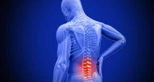 spine related issue treatment Best chiropractor in Hyderabad