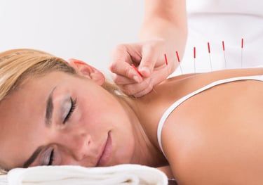 Acupuncture treatment