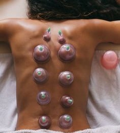 Cupping Therapy
