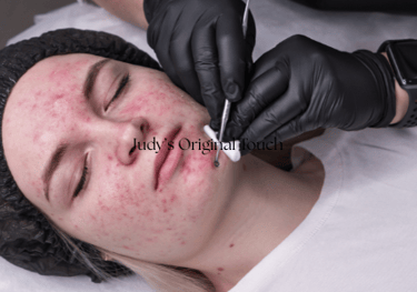 a woman getting a facial lift from an esthetician