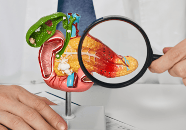 Pancreas Cancer treatment ahmedabad