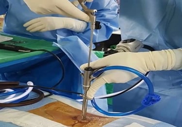 Dr Gilnard opera Cirurgia endoscópica da coluna em Fortaleza Ceará