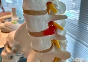 Dr Gilnard opera hérnia de disco em Fortaleza Ceará