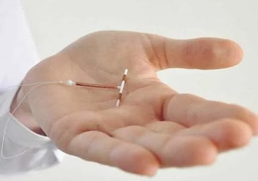 A copper IUD intrauterine device held in an open palm for contraceptive birth control.