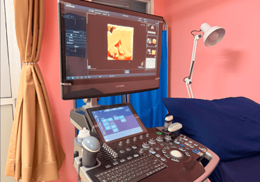 Professional 4D ultrasound machine in a clinic displaying a prenatal baby scan on the monitor.