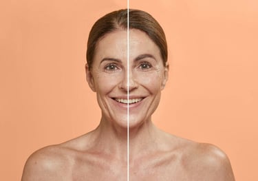 combinal eyebrow lifting