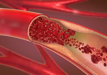 Peripheral Vascular Disease in Amman Jordan