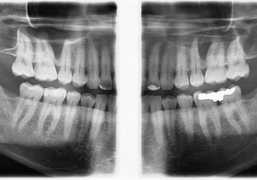 Maryville TN General Dentistry