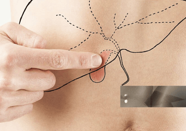 Best Gallbladder stone surgeon in Ballia Uttarpradesh 