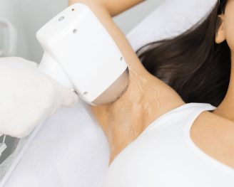 Épilation laser chez Insia Beauté – séance en clinique esthétique pour peau plus lisse