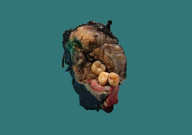 anatomía patológica cabeza y cuello