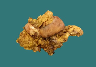 anatomía patológica aparto digestivo