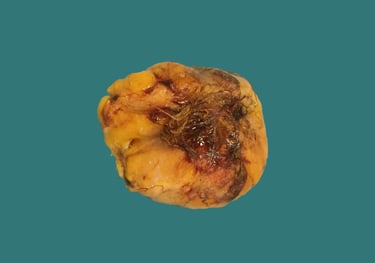 anatomía patológica partes blandas