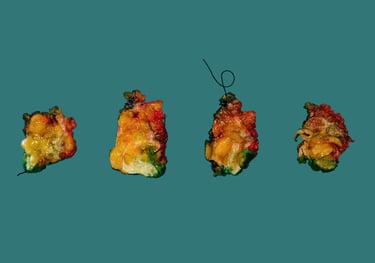 anatomía patológica mama