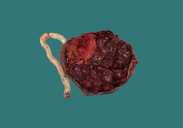 anatomía patológica obstetricia y ginecología