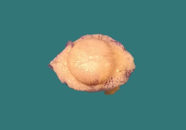 anatomía patológica dermatopatología