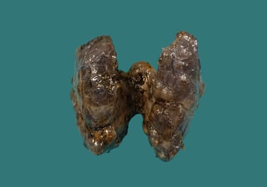 anatomía patológica endocrino