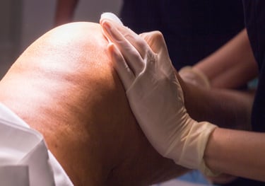 Drainage lymphatique pour dégonfler en péri-ménopause, en cas de lipoedème, en pré et post-opératoir