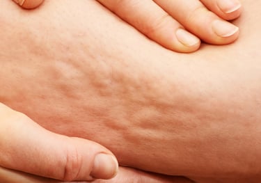 Drainage lymphatique pour rétention d'eau, cellulite, ventre plat, ventre gonflé, 